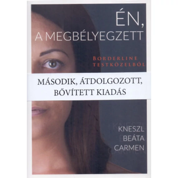 Én, a megbélyegzett - Borderline testközelből - Kneszl  Beáta Carmen
